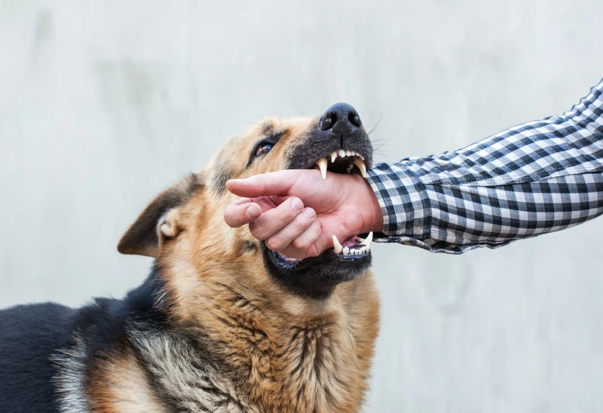 German shepherd biting a man's arm